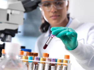 Cholesterol ApoB and Lp(a)_featured image